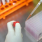 CE Registered Monkeypox Virus Rapid Antigen Test Kit Colloidal Gold High Accuracy