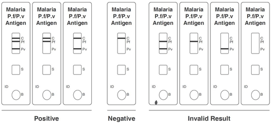Malaria PF/PV Antigen Rapid Test Kit Colloidal Gold CE Registered